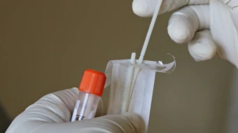 ДОТ вперше закуповує системи для відбору біологічних зразків у військовослужбовців Збройних сил