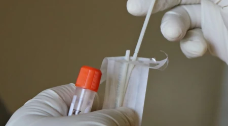 ДОТ вперше закуповує системи для відбору біологічних зразків у військовослужбовців Збройних сил